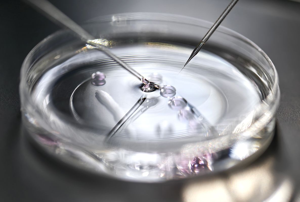 A close-up view of a petri dish containing small droplets of liquid. Two pipettes are positioned over the dish, indicating a scientific experiment or procedure, such as sample handling or cell culture. The background is softly blurred, emphasizing the dish and pipettes.