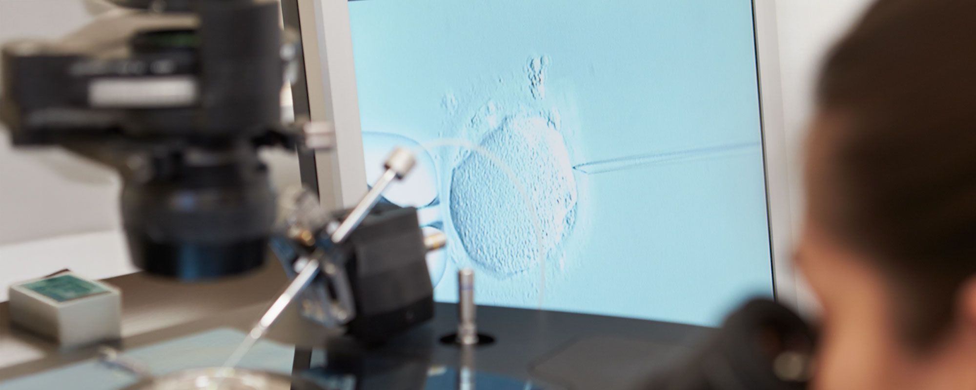 Mikroskopbild einer Eizelle